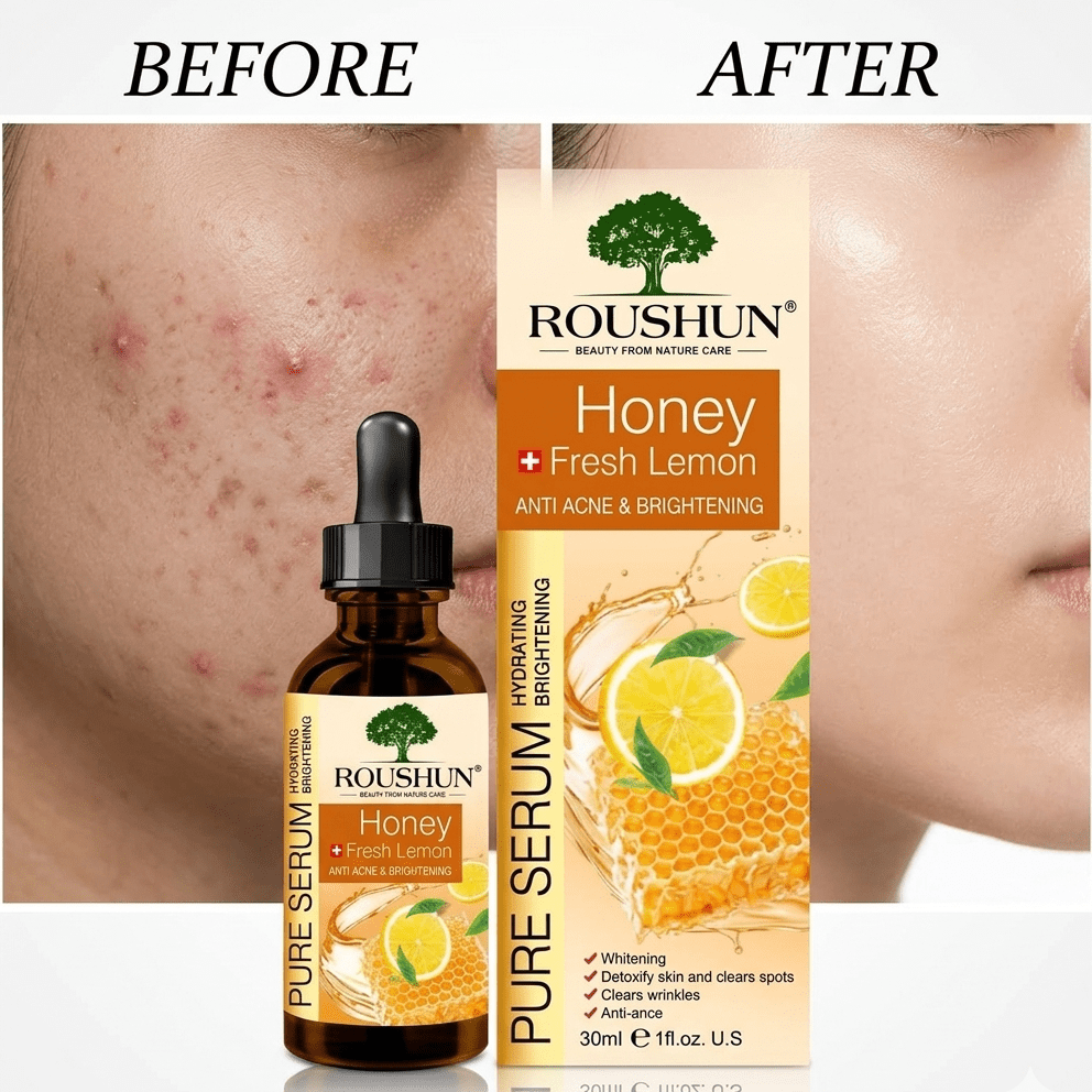 Roushun Honey Fresh Lemon Pure Serum (30ml) | Anti Acne & Brightening Face Serum - The Nexa Shop