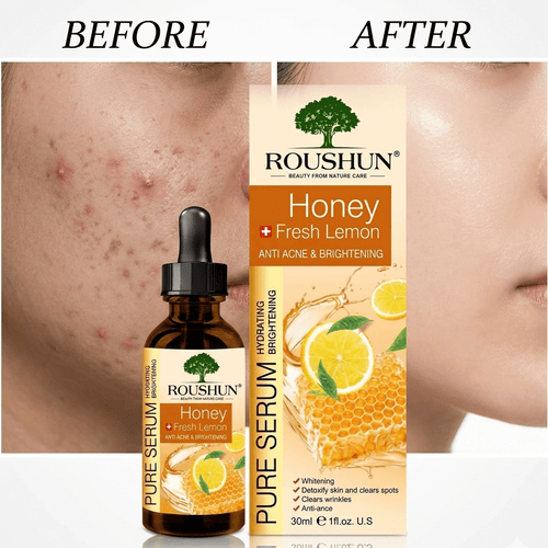 Roushun Honey Fresh Lemon Pure Serum (30ml) | Anti Acne & Brightening Face Serum - The Nexa Shop